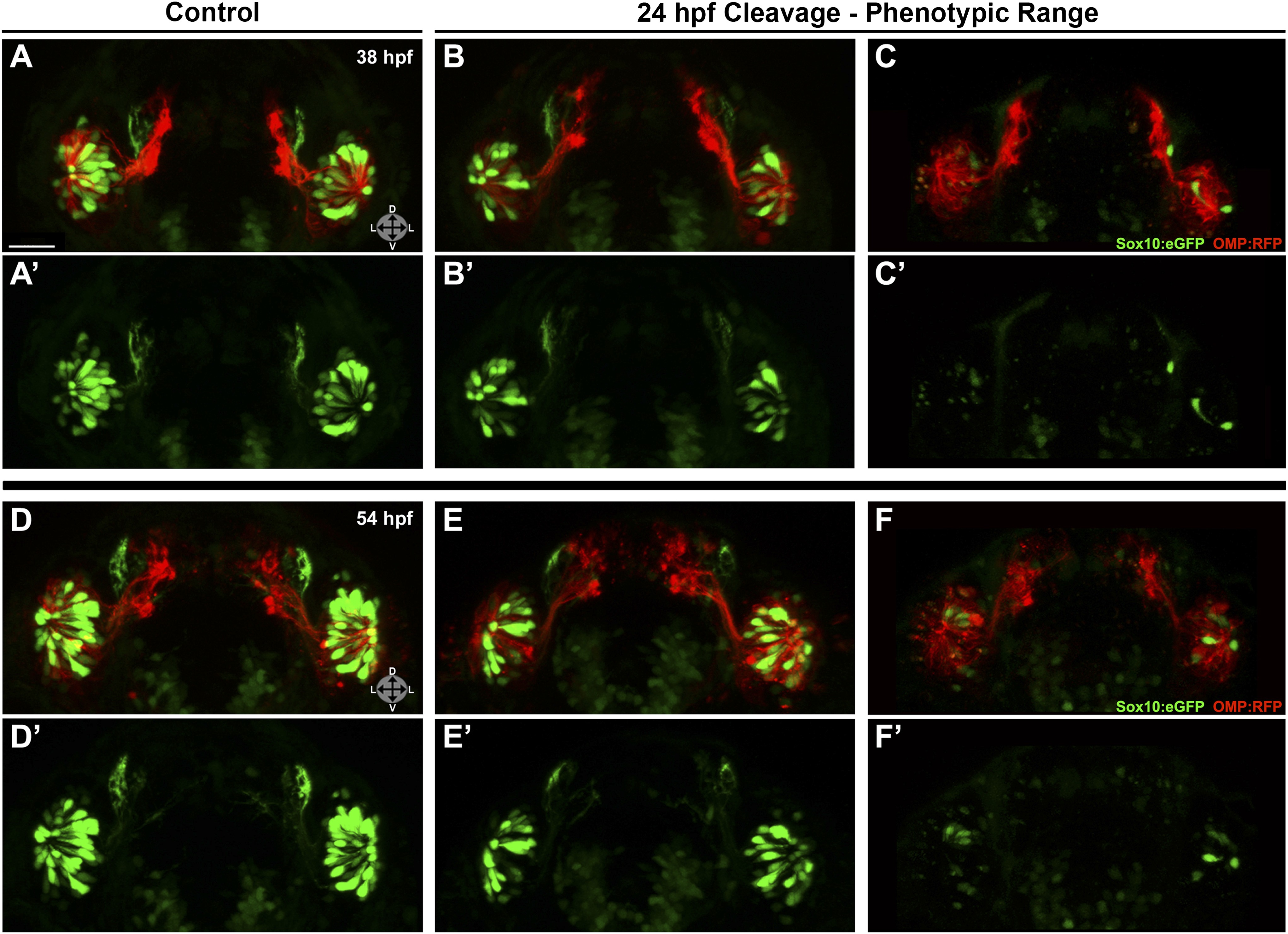 Sox10-dependent neural crest origin of olfactory microvillous neurons ...