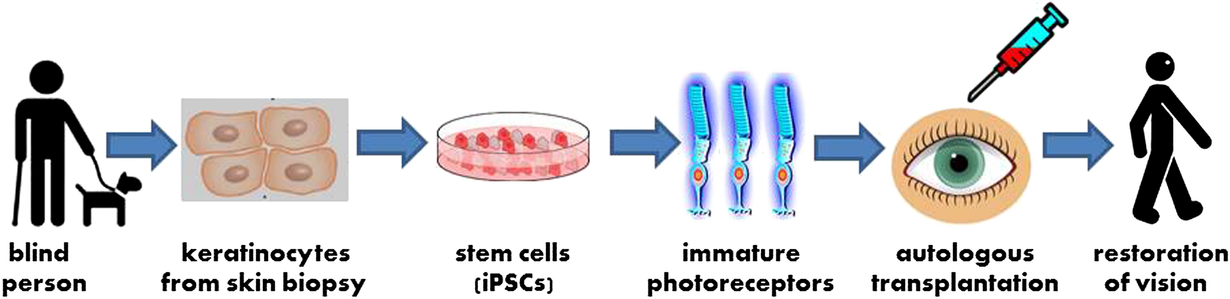 Stem Cells Set Their Sights On Retinitis Pigmentosa | ELife