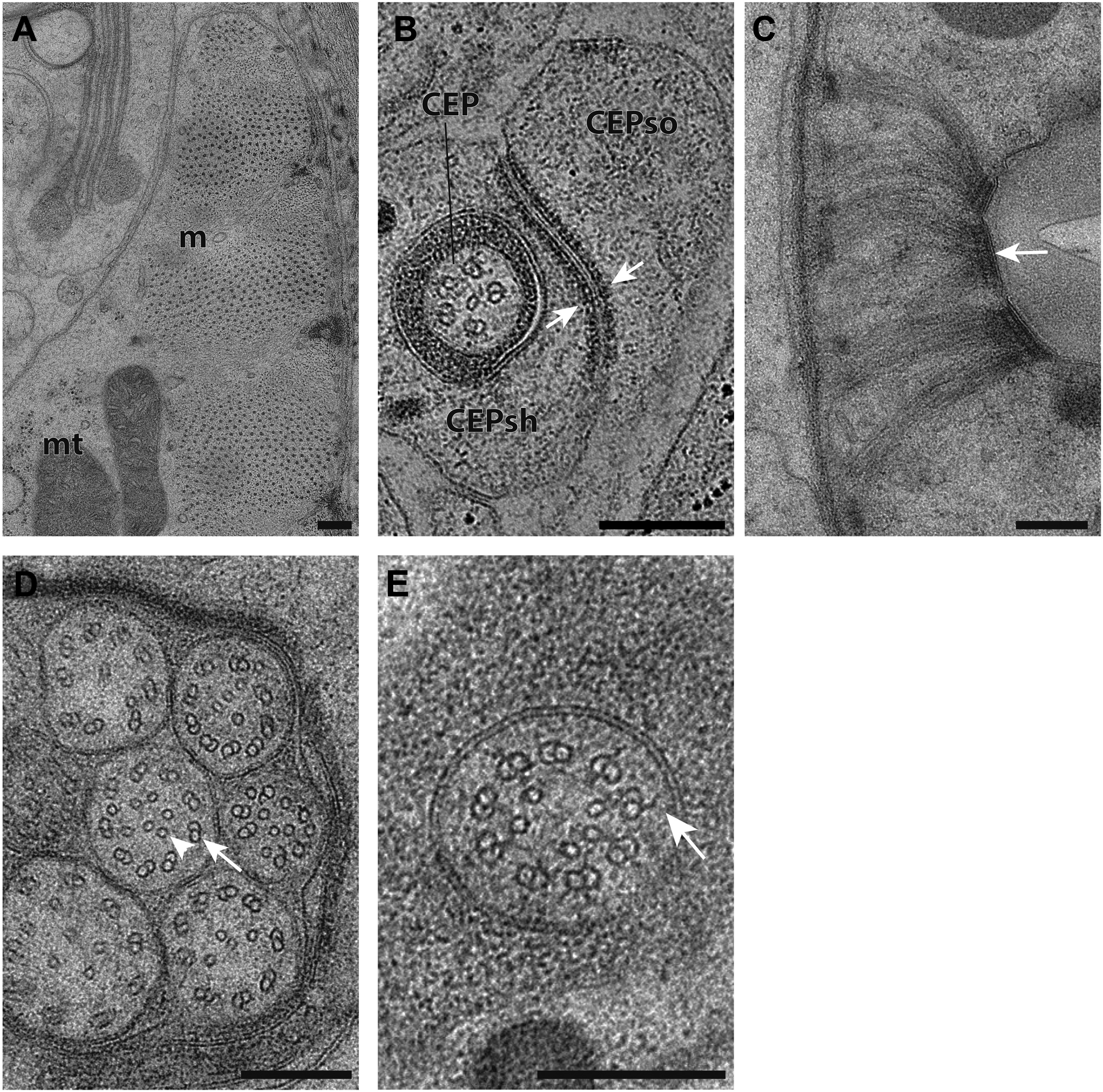 A High Resolution Morphological And Ultrastructural Map Of Anterior Sensory Cilia And Glia In Caenorhabditis Elegans Elife Lens