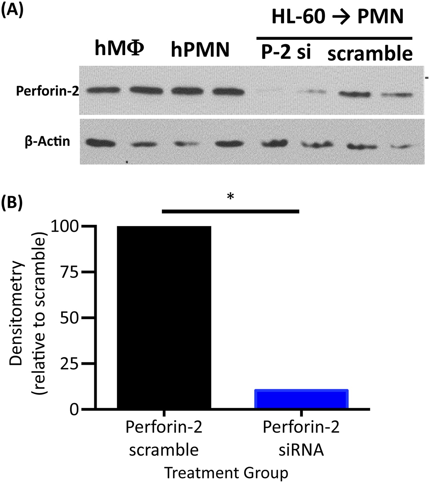 Perforin Rats Perforin-2 is essential for intracellular defense of parenchymal cells ...