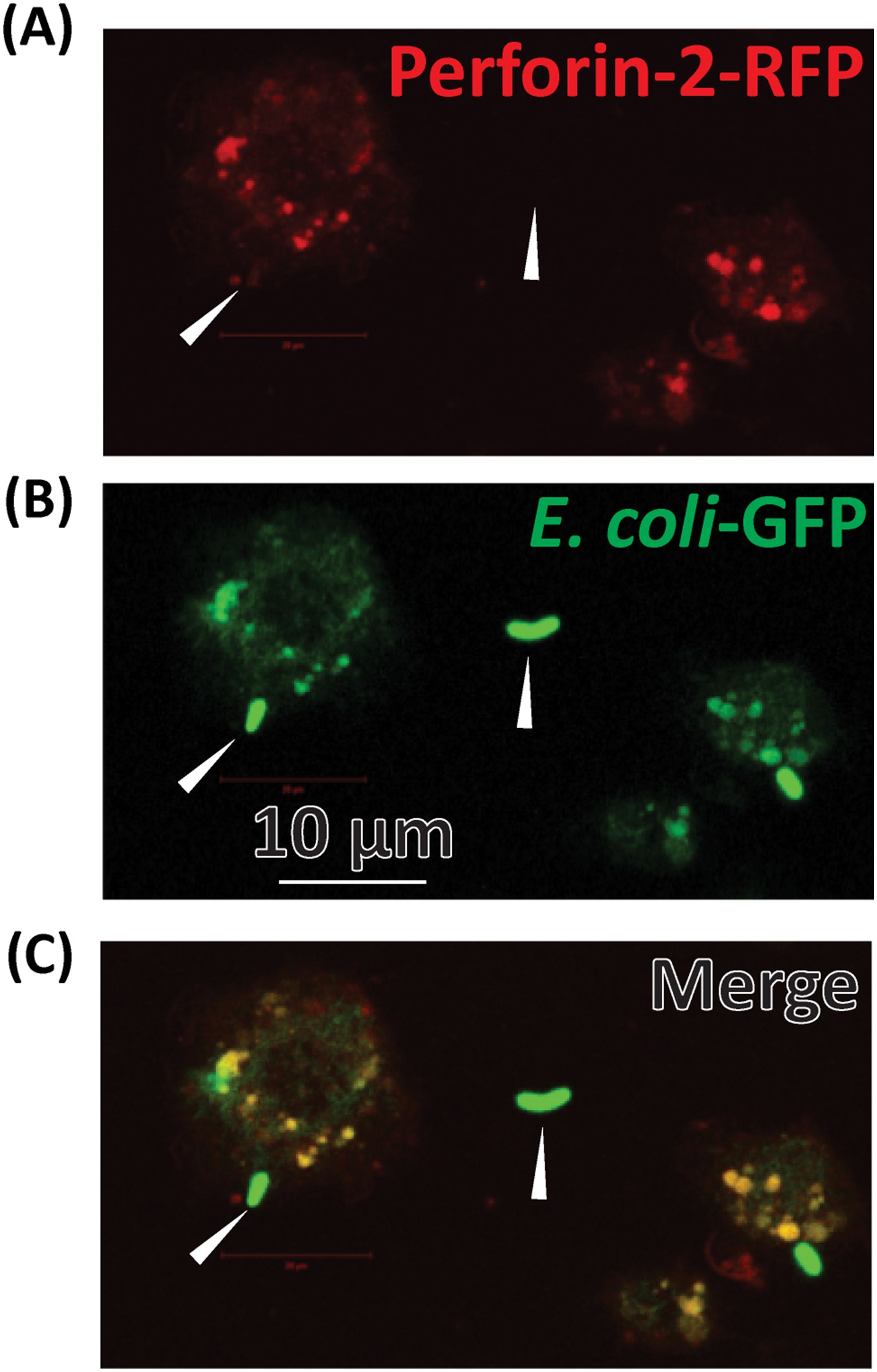 Perforine Perforin-2 is essential for intracellular defense of parenchymal cells ...