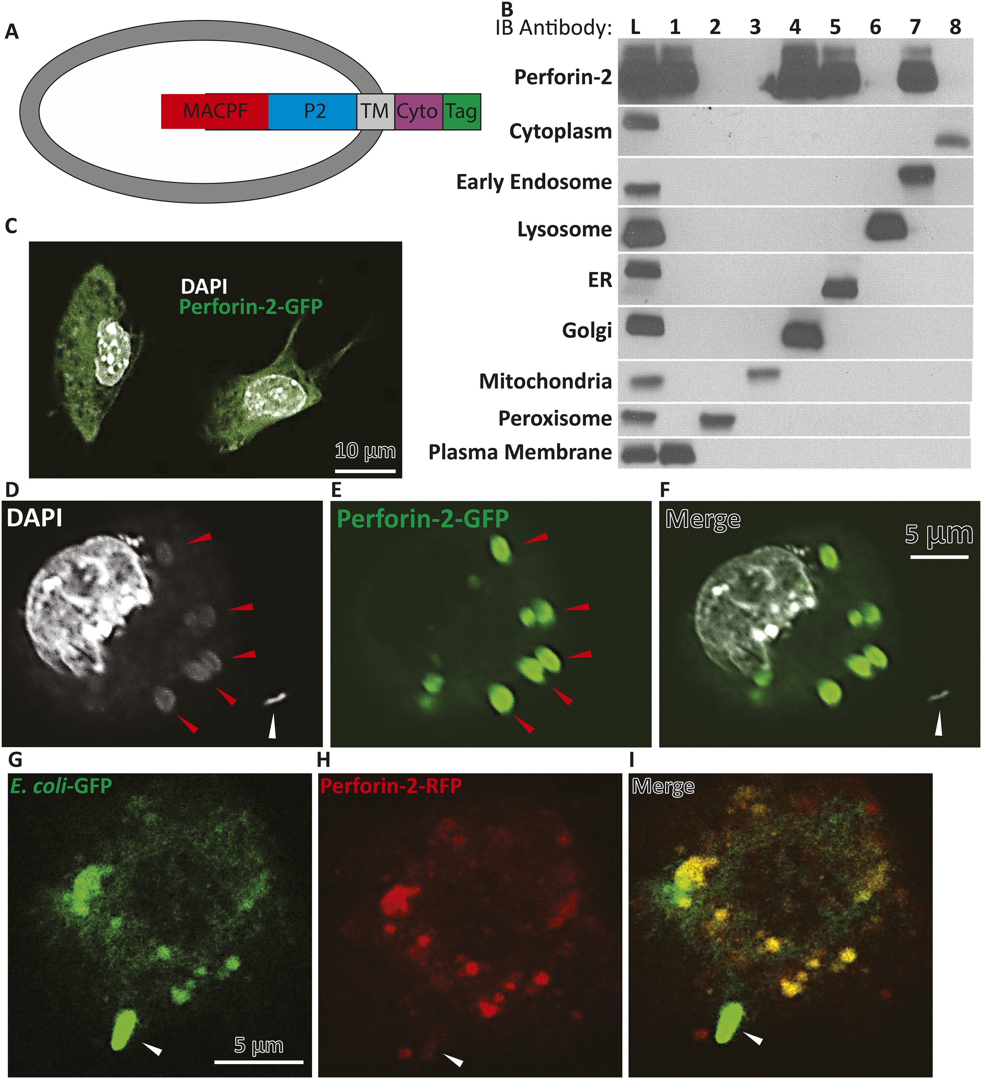 Perforin Rats Perforin-2 is essential for intracellular defense of parenchymal cells ...