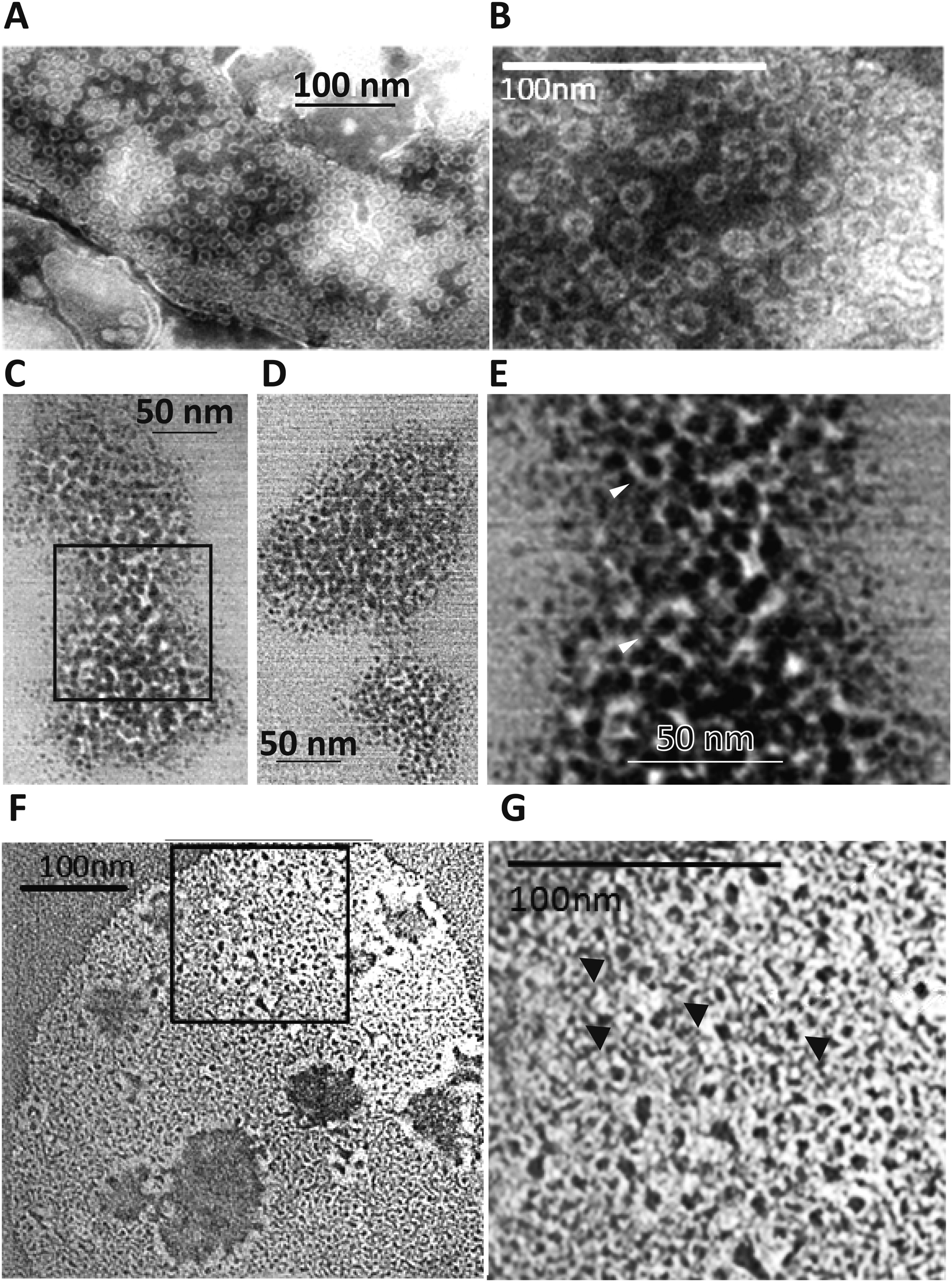 Perforin Rats Perforin-2 is essential for intracellular defense of parenchymal cells ...