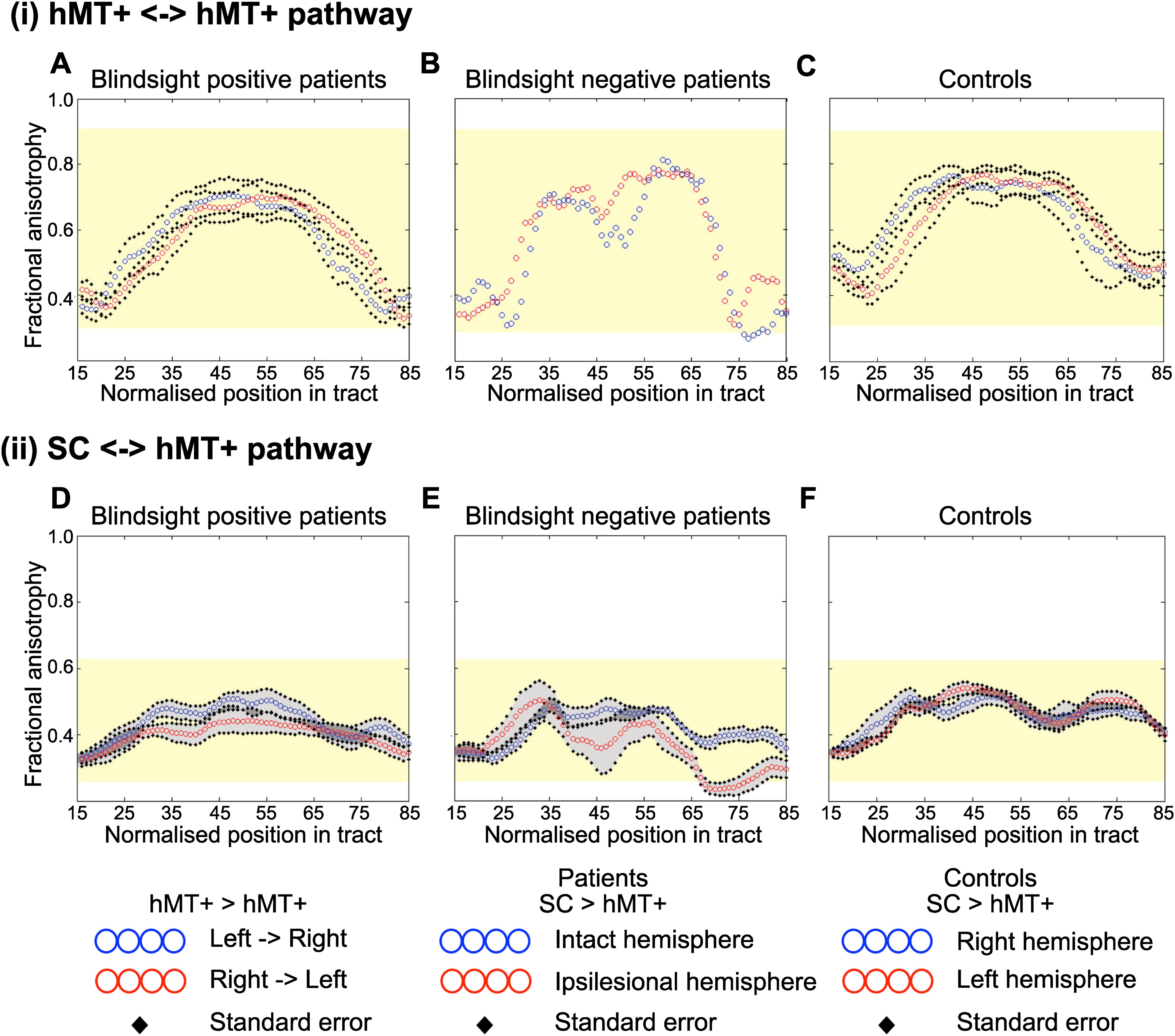 Human Blindsight Is Mediated By An Intact Geniculo-extrastriate Pathway ...