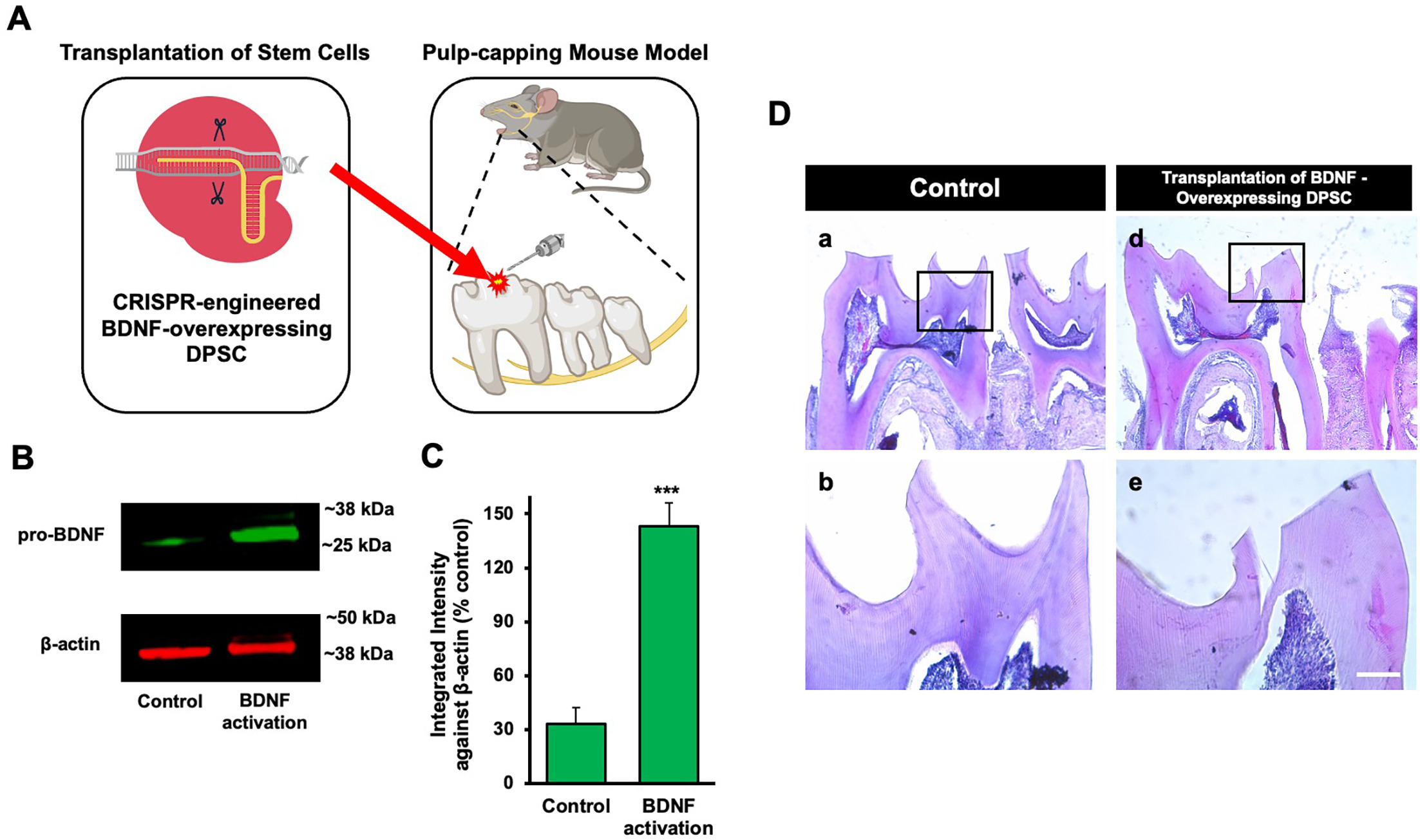 CRISPR-edited DPSCs constitutively expressing BDNF enhance dentin ...