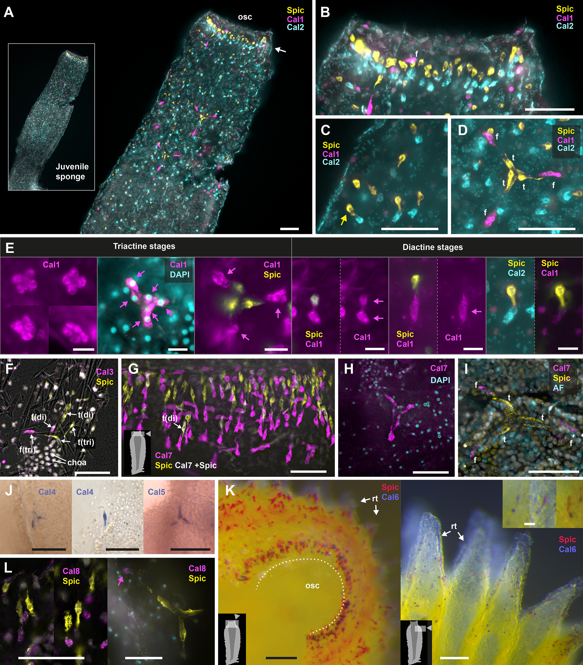 Genetic parallels in biomineralization of the calcareous sponge Sycon ...