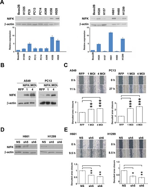 The nucleolar protein NIFK promotes cancer progression via CK1α/β ...