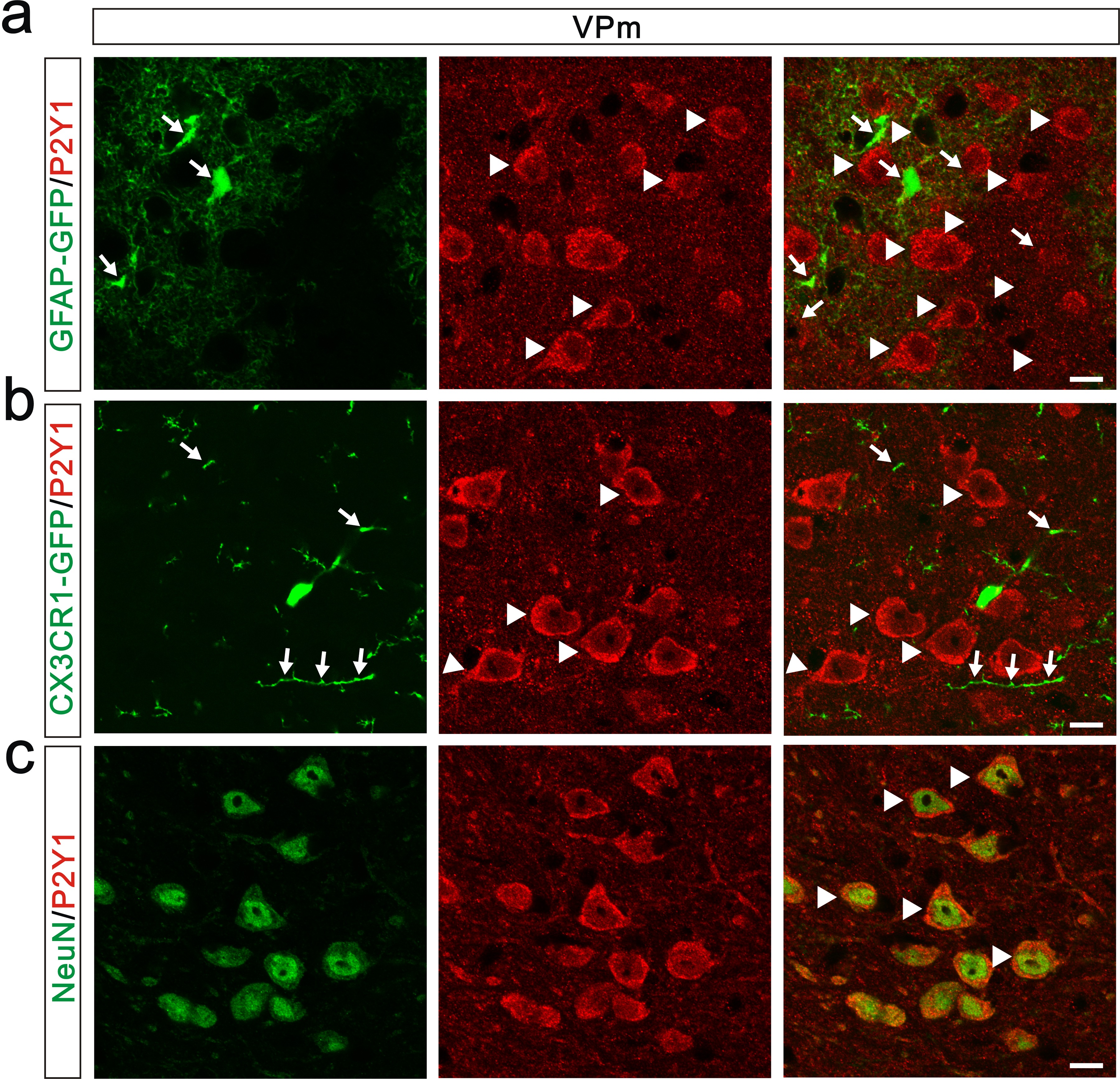 elife-15043-fig4-figsupp1-v1.jpg