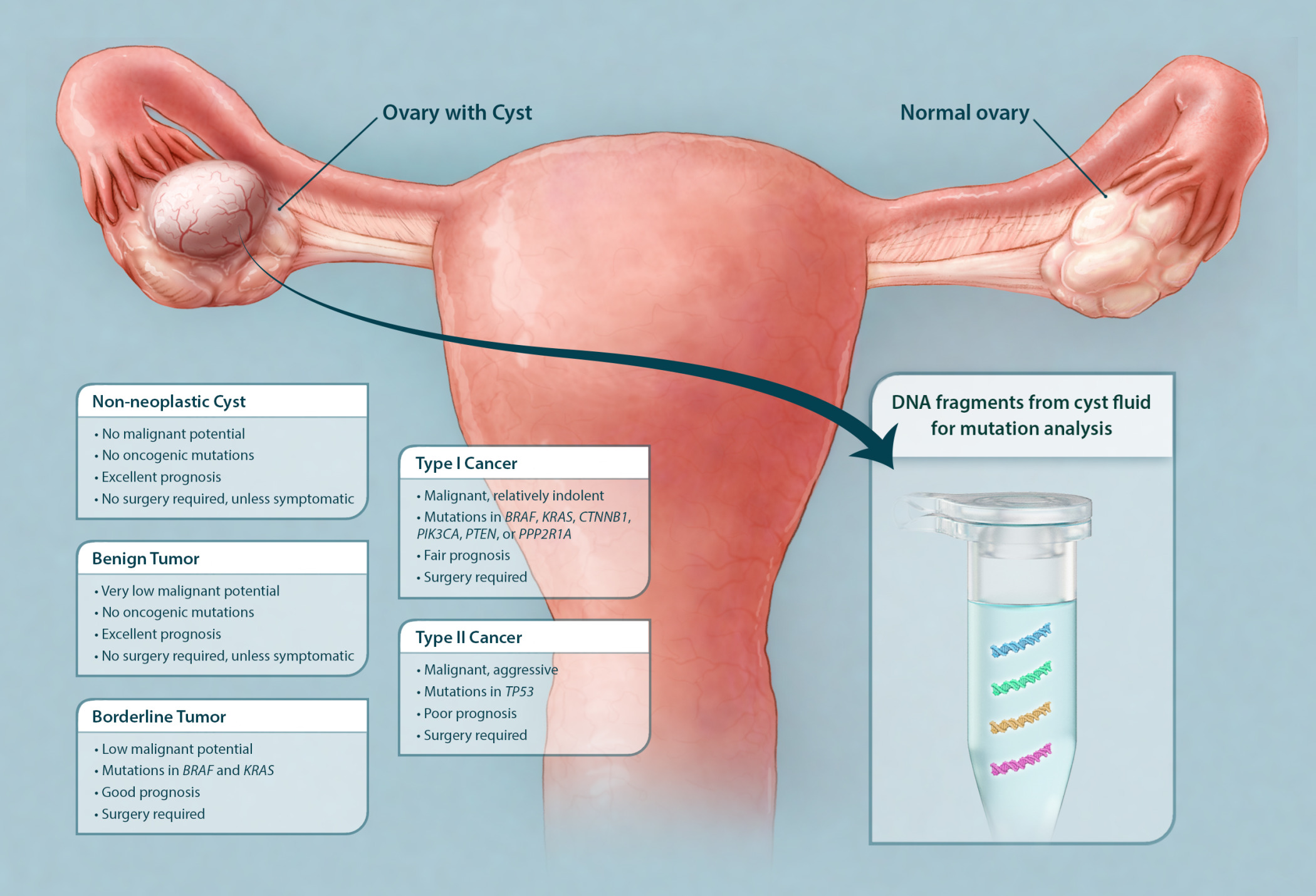 Do Ovarian Cysts Leak Fluid