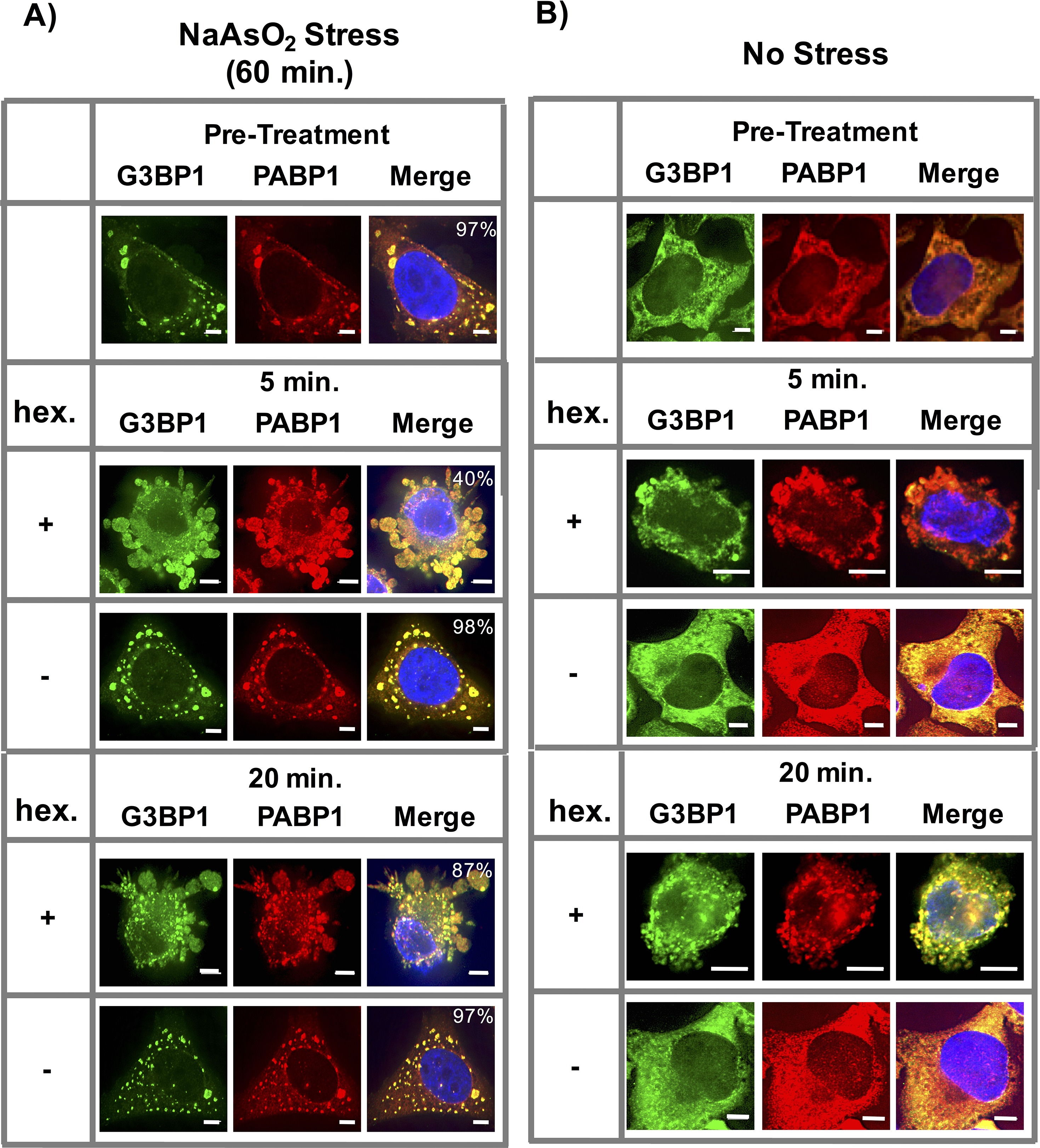 Distinct stages in stress granule assembly and disassembly | eLife