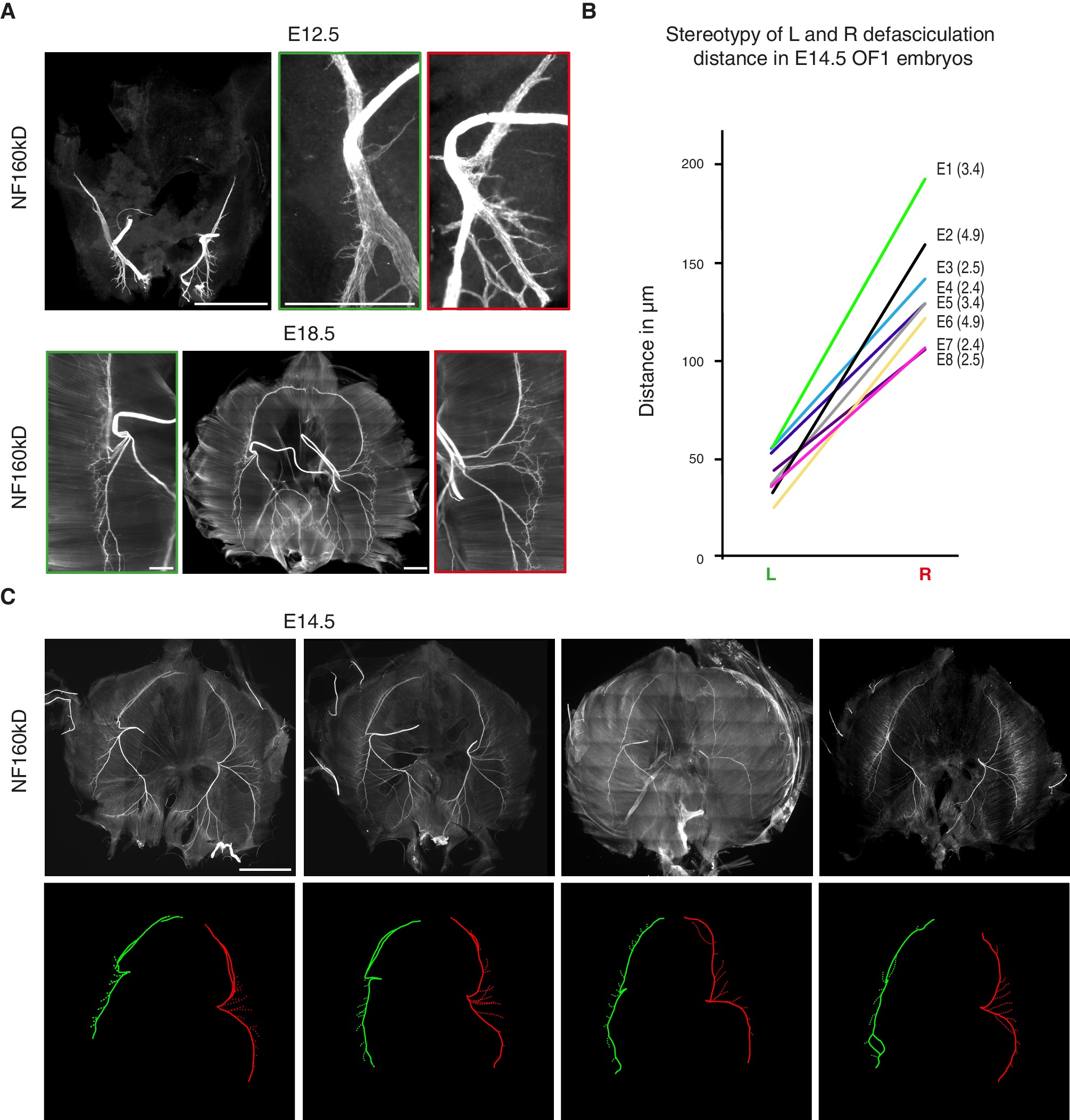 Genetic Specification Of Left Right Asymmetry In The Diaphragm Muscles And Their Motor Innervation Elife Lens