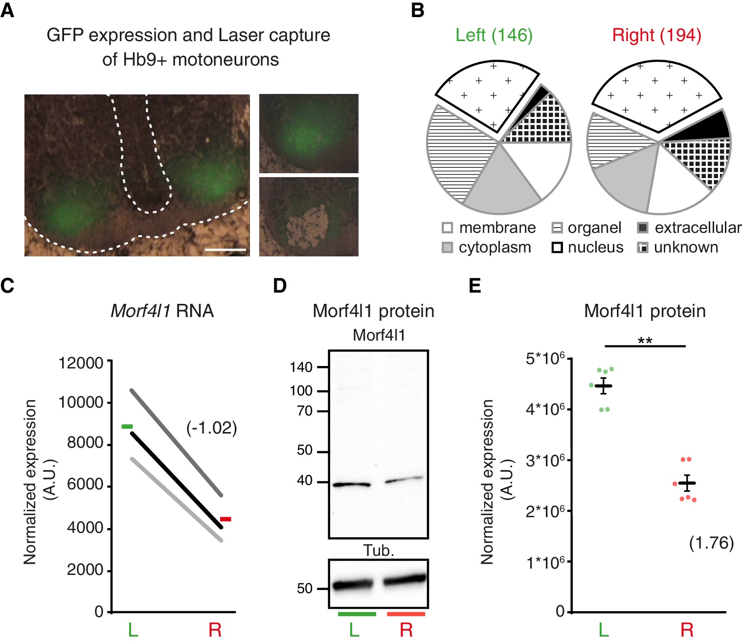 Genetic Specification Of Left Right Asymmetry In The Diaphragm Muscles And Their Motor Innervation Elife Lens