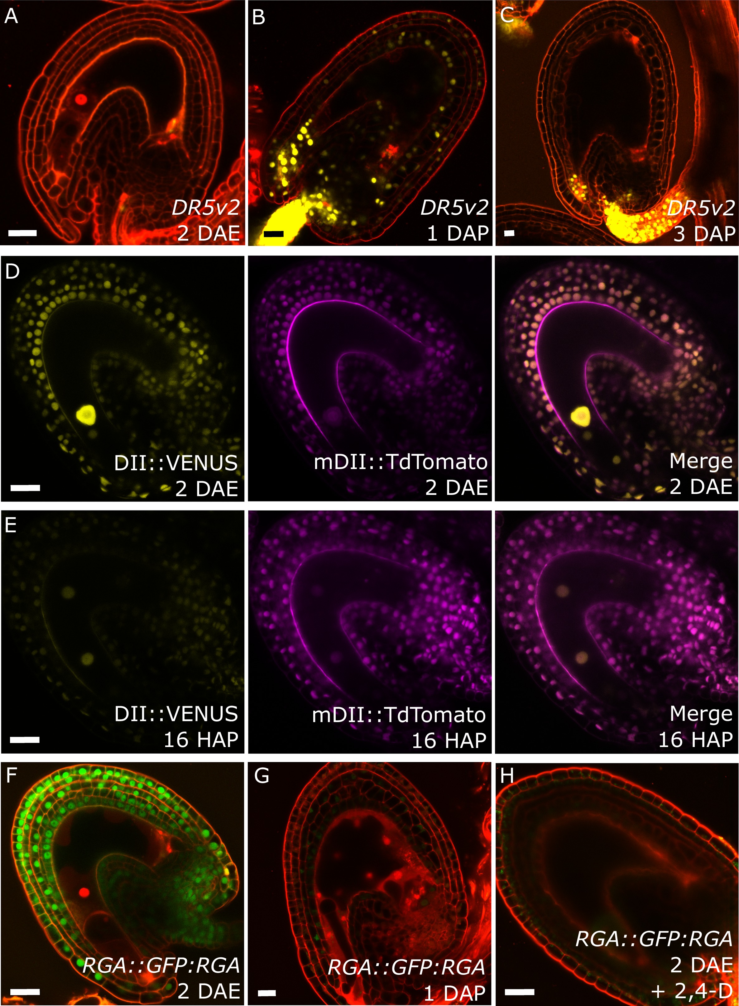 Auxin production in the endosperm drives seed coat development in ...