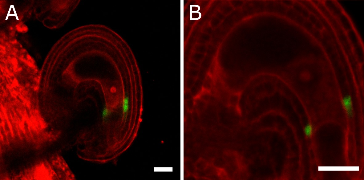 Auxin production in the endosperm drives seed coat development in ...