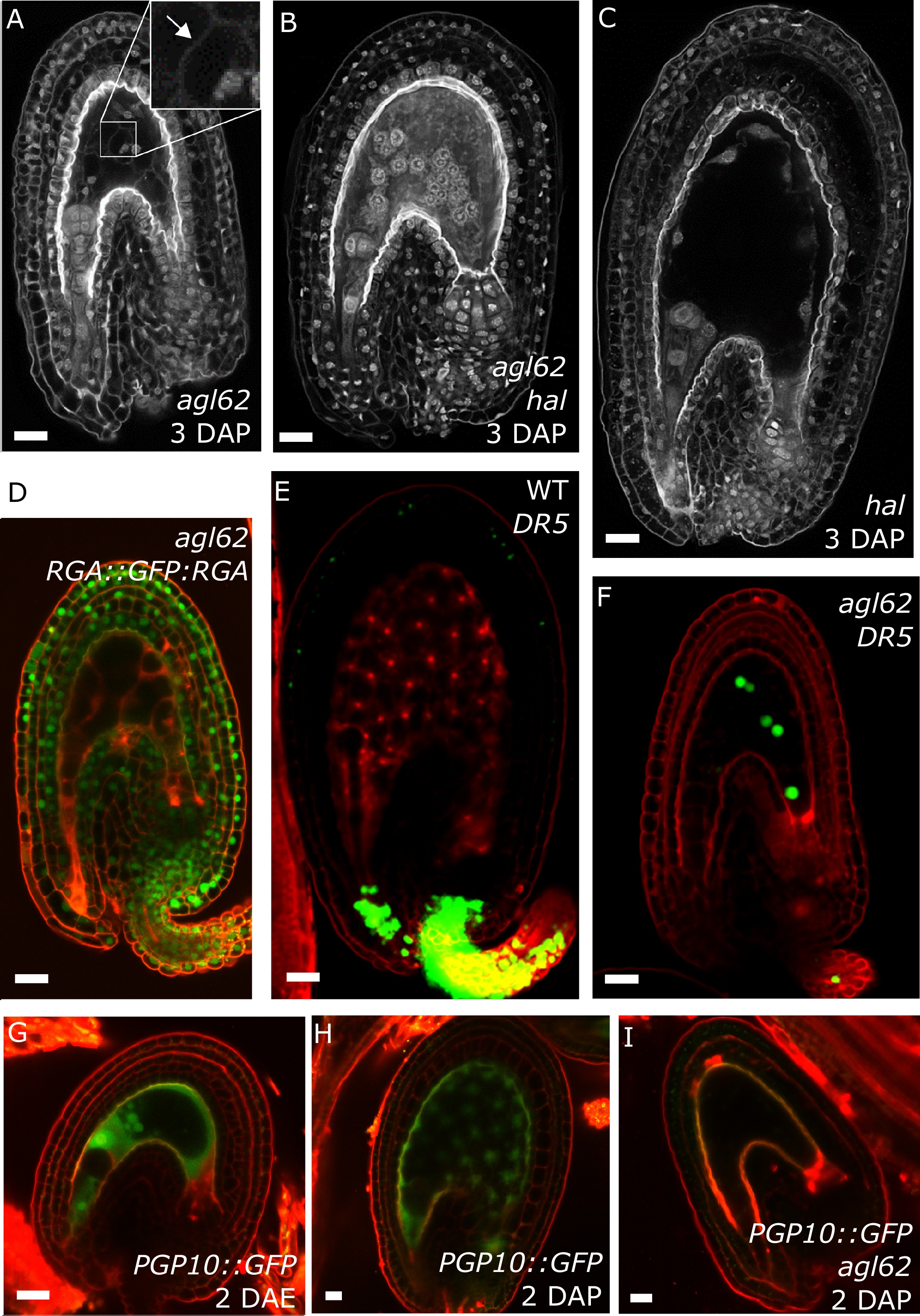 Auxin production in the endosperm drives seed coat development in ...