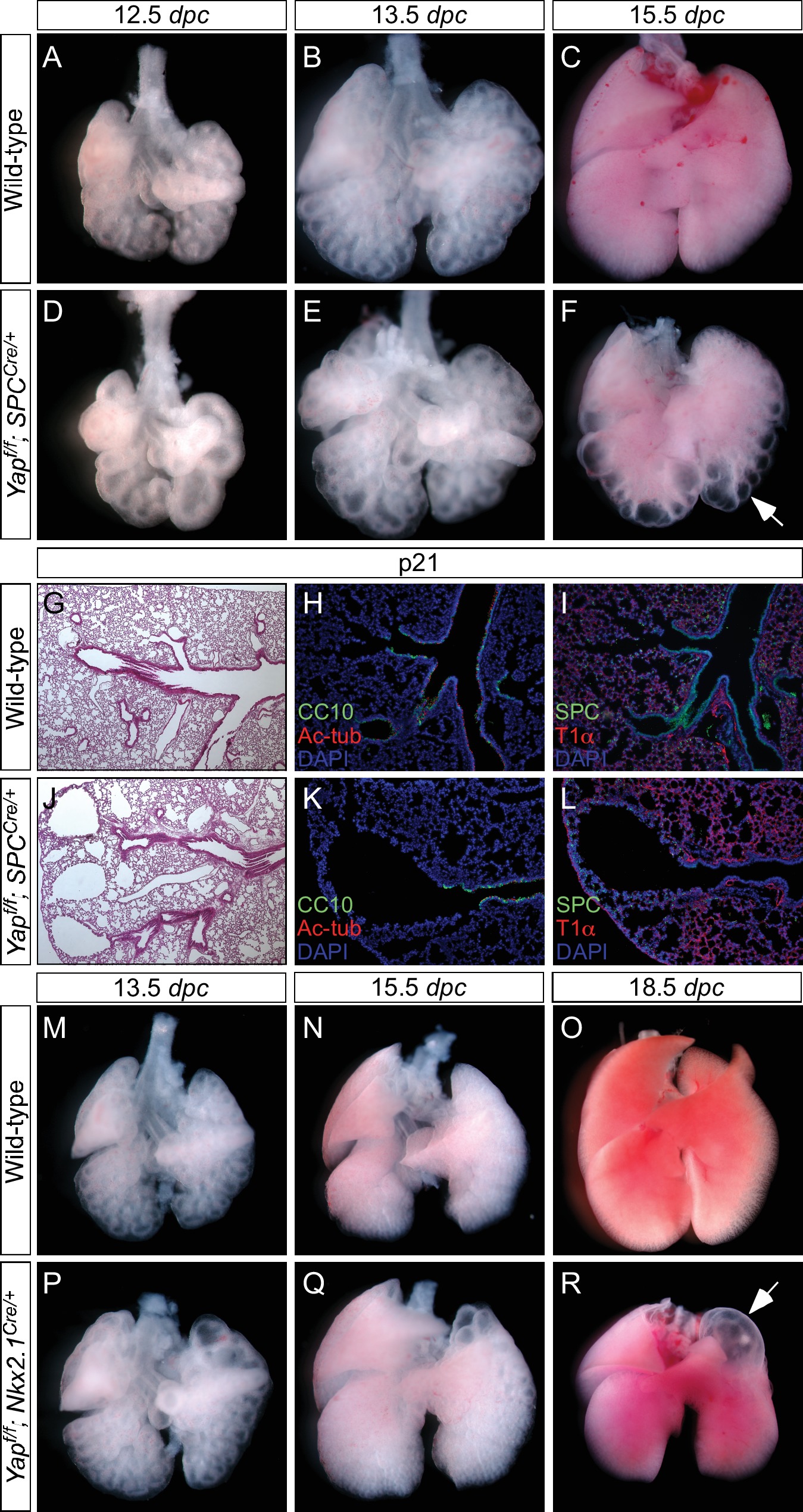 YAP is essential for mechanical force production and epithelial cell ...