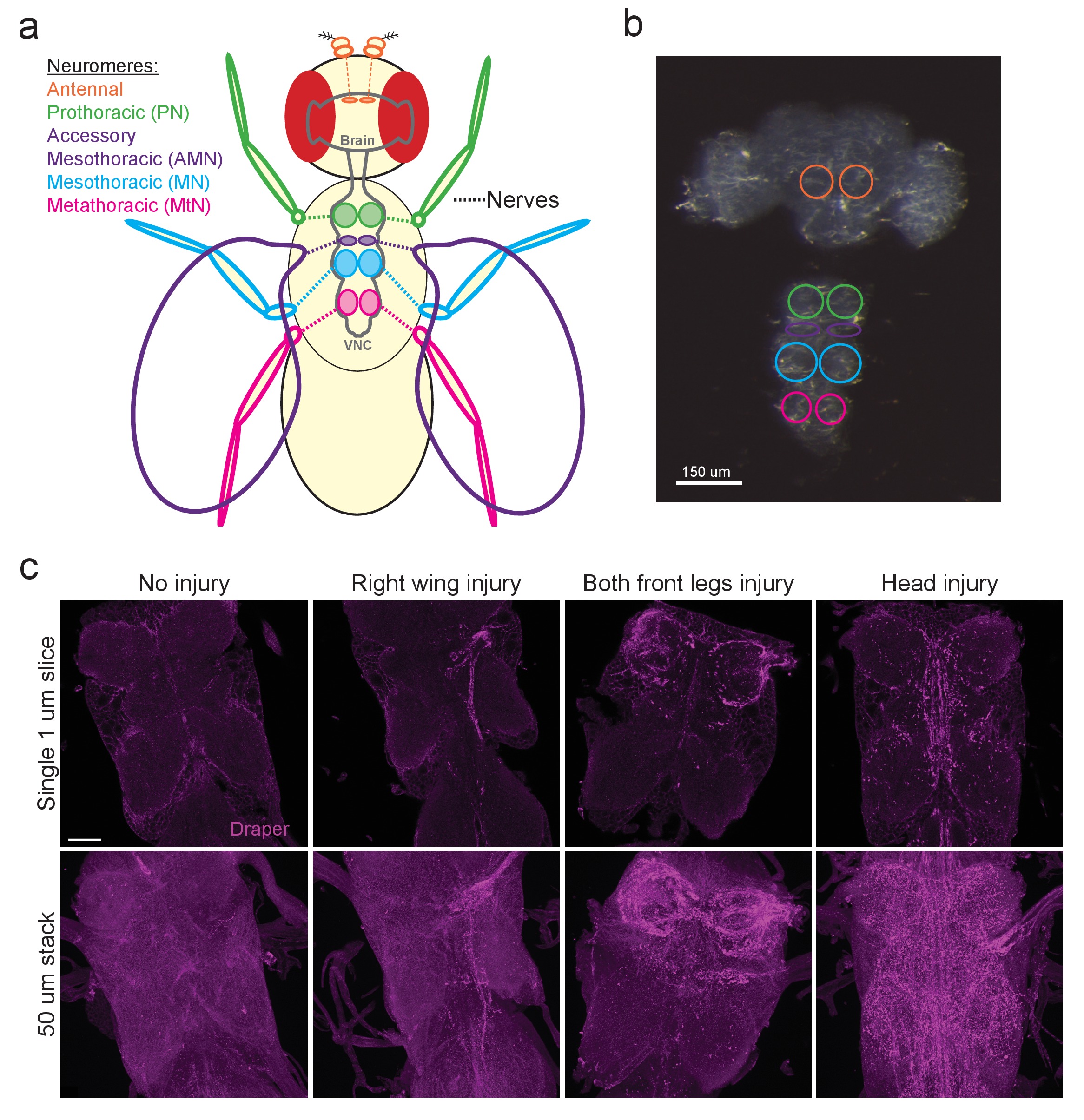 A novel Drosophila injury model reveals severed axons are cleared ...