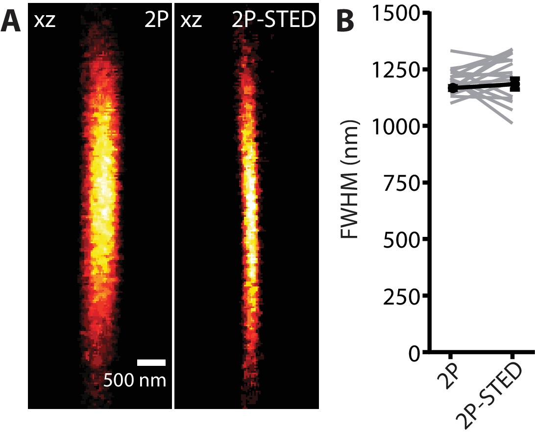 Chronic 2P-STED imaging reveals high turnover of dendritic spines in ...