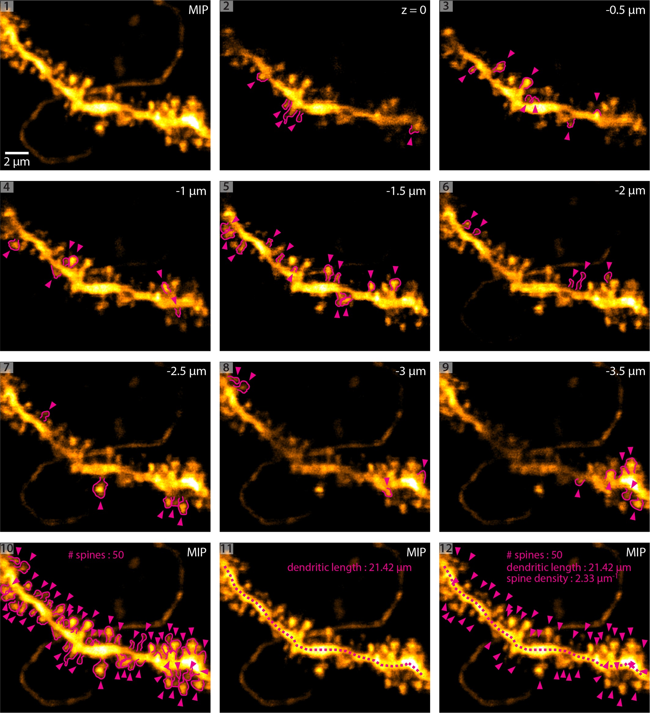 Chronic 2P-STED imaging reveals high turnover of dendritic spines in ...