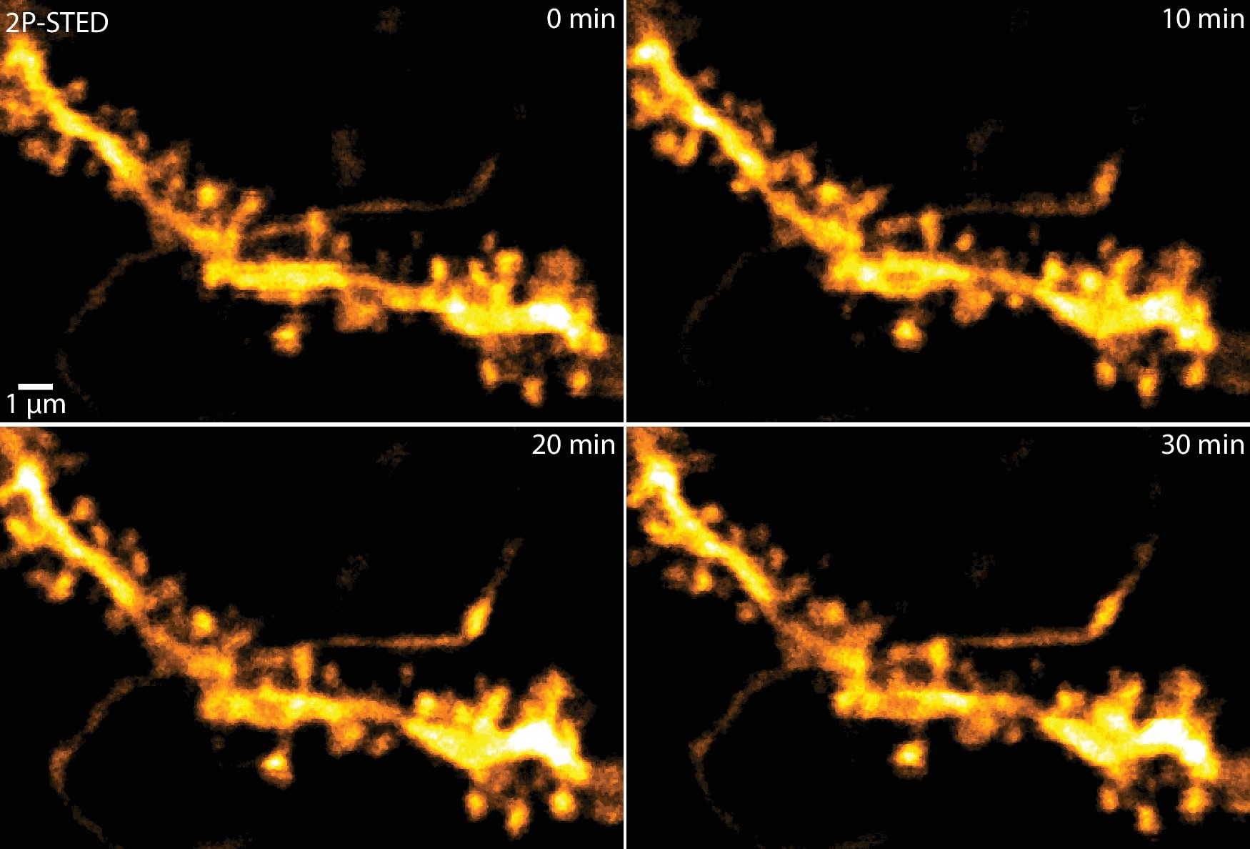 Chronic 2P-STED imaging reveals high turnover of dendritic spines in ...