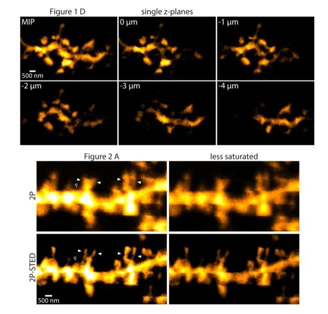 Chronic 2P-STED imaging reveals high turnover of dendritic spines in ...