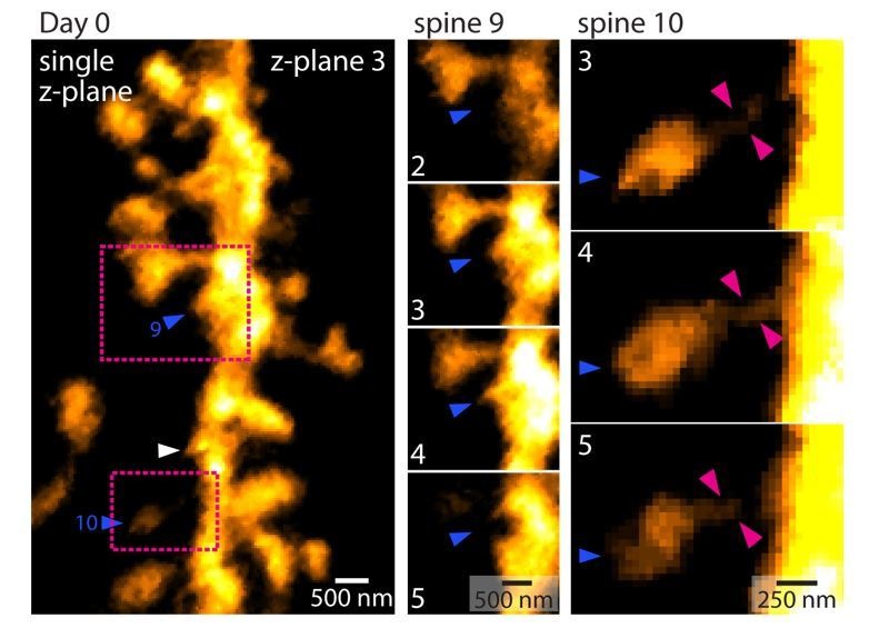 Chronic 2P-STED imaging reveals high turnover of dendritic spines in ...