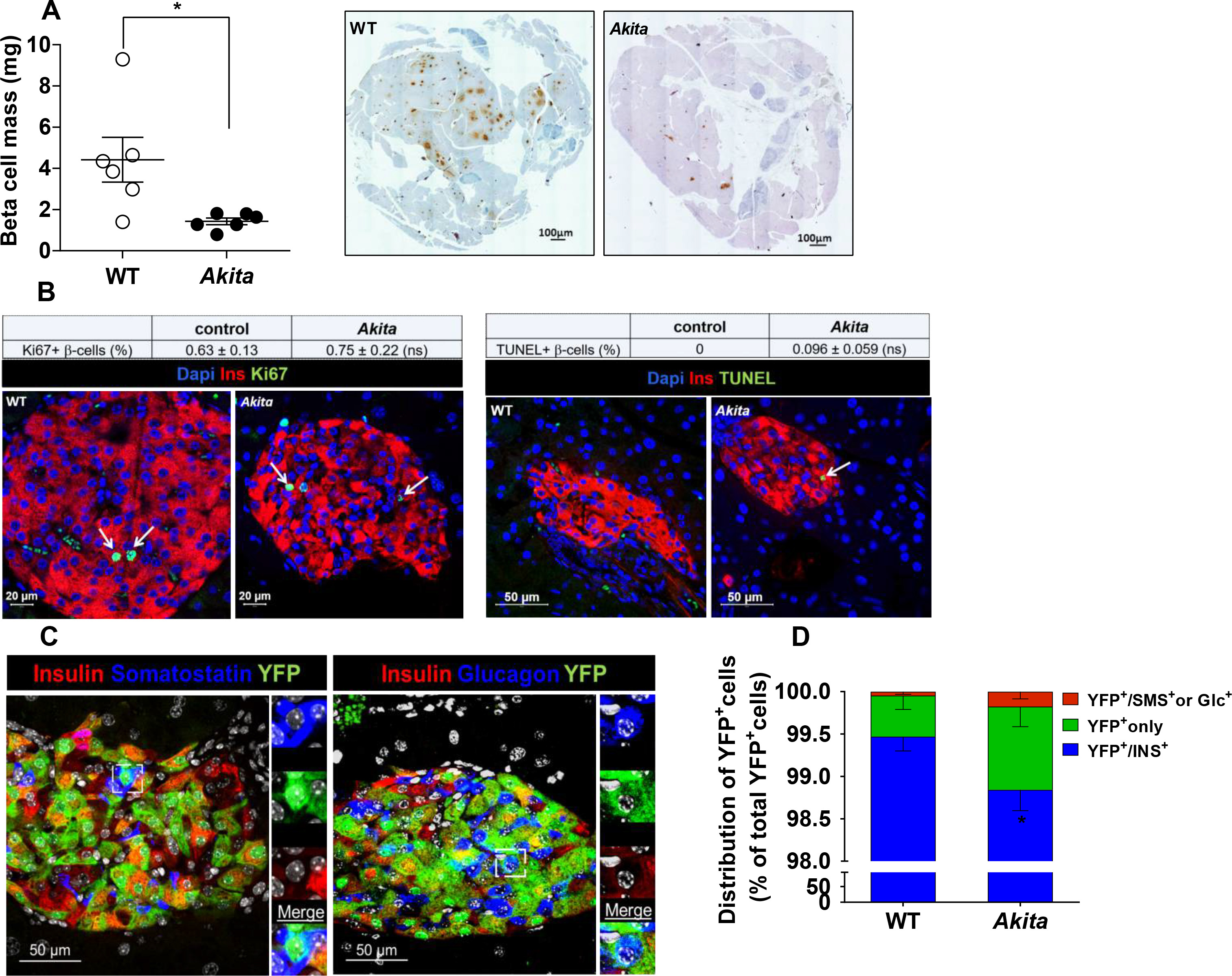 Inhibition of mTORC1 by ER stress impairs neonatal β-cell expansion and ...