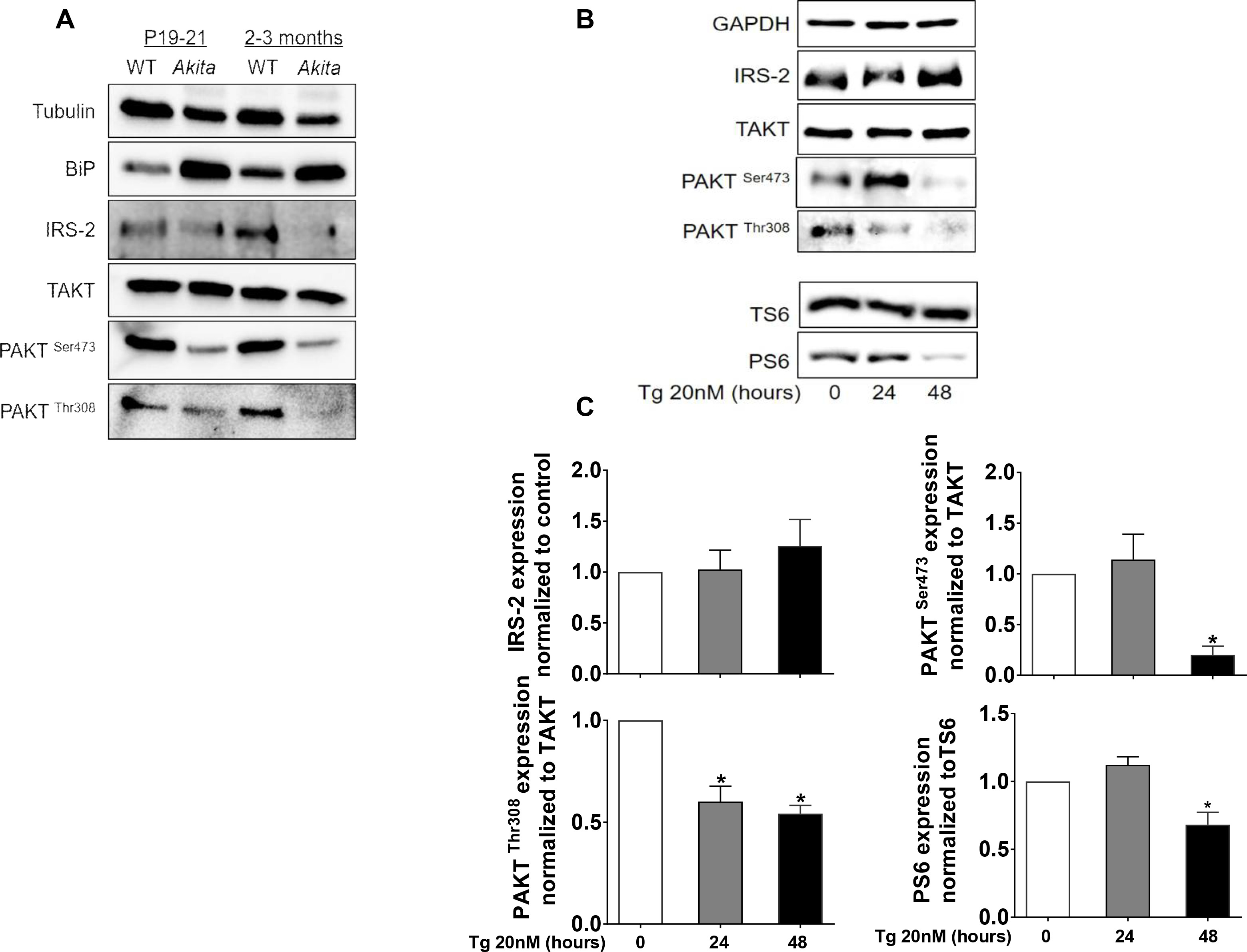 Inhibition of mTORC1 by ER stress impairs neonatal β-cell expansion and ...