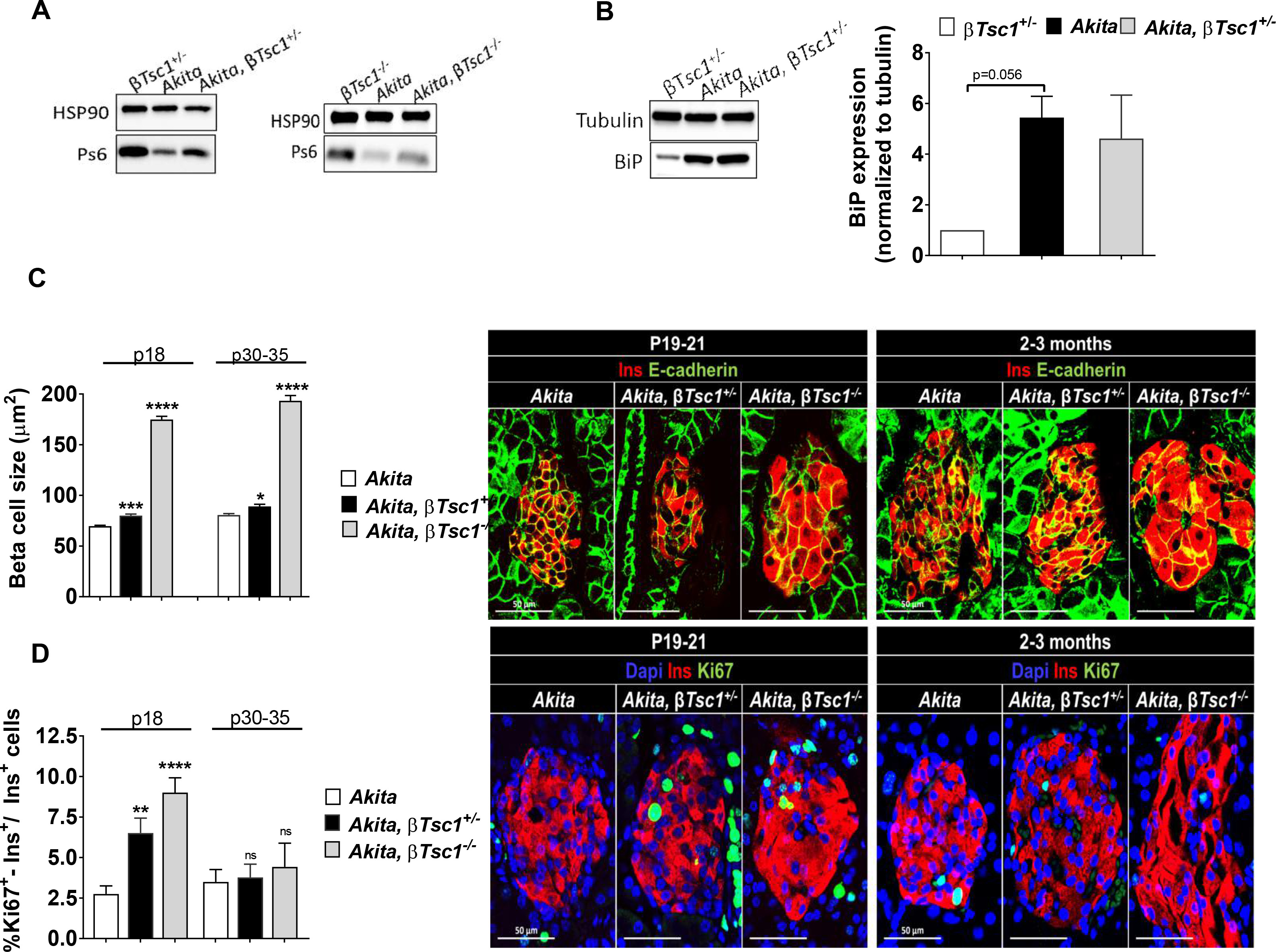 Inhibition of mTORC1 by ER stress impairs neonatal β-cell expansion and ...
