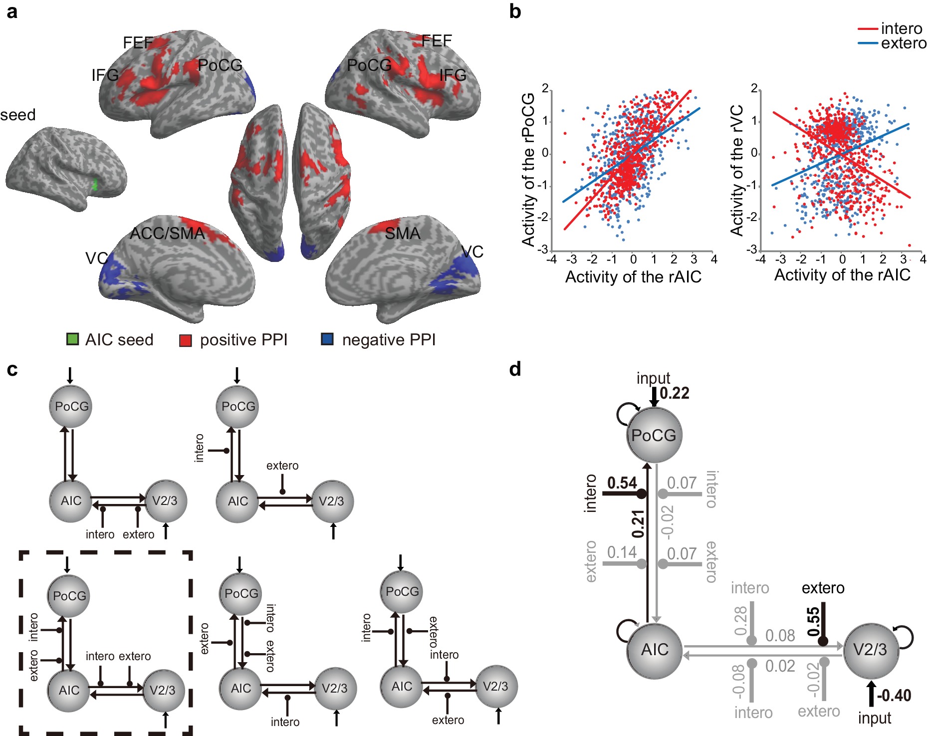 Anterior insular cortex plays a critical role in interoceptive ...