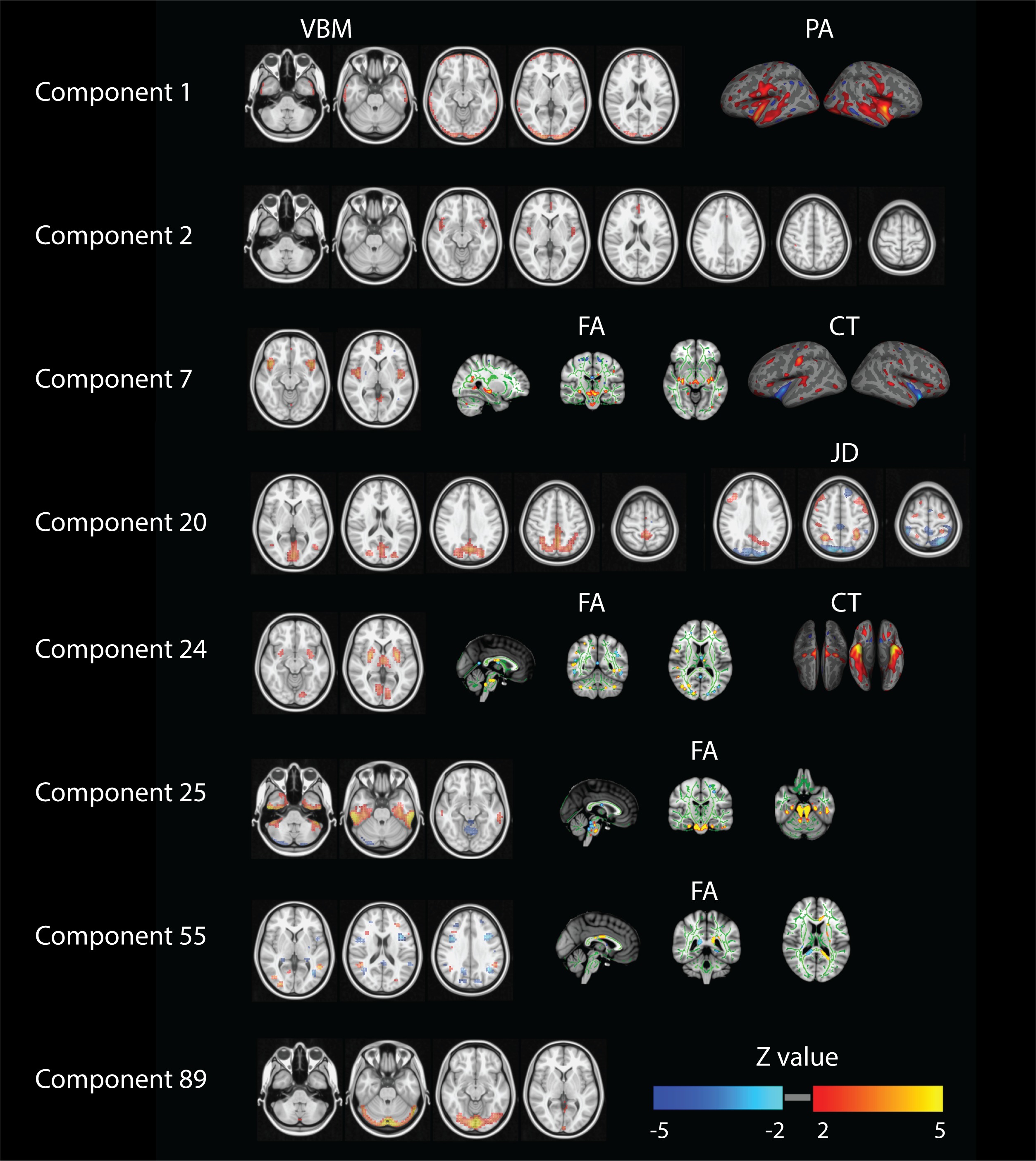 Inter-individual differences in human brain structure and morphology ...