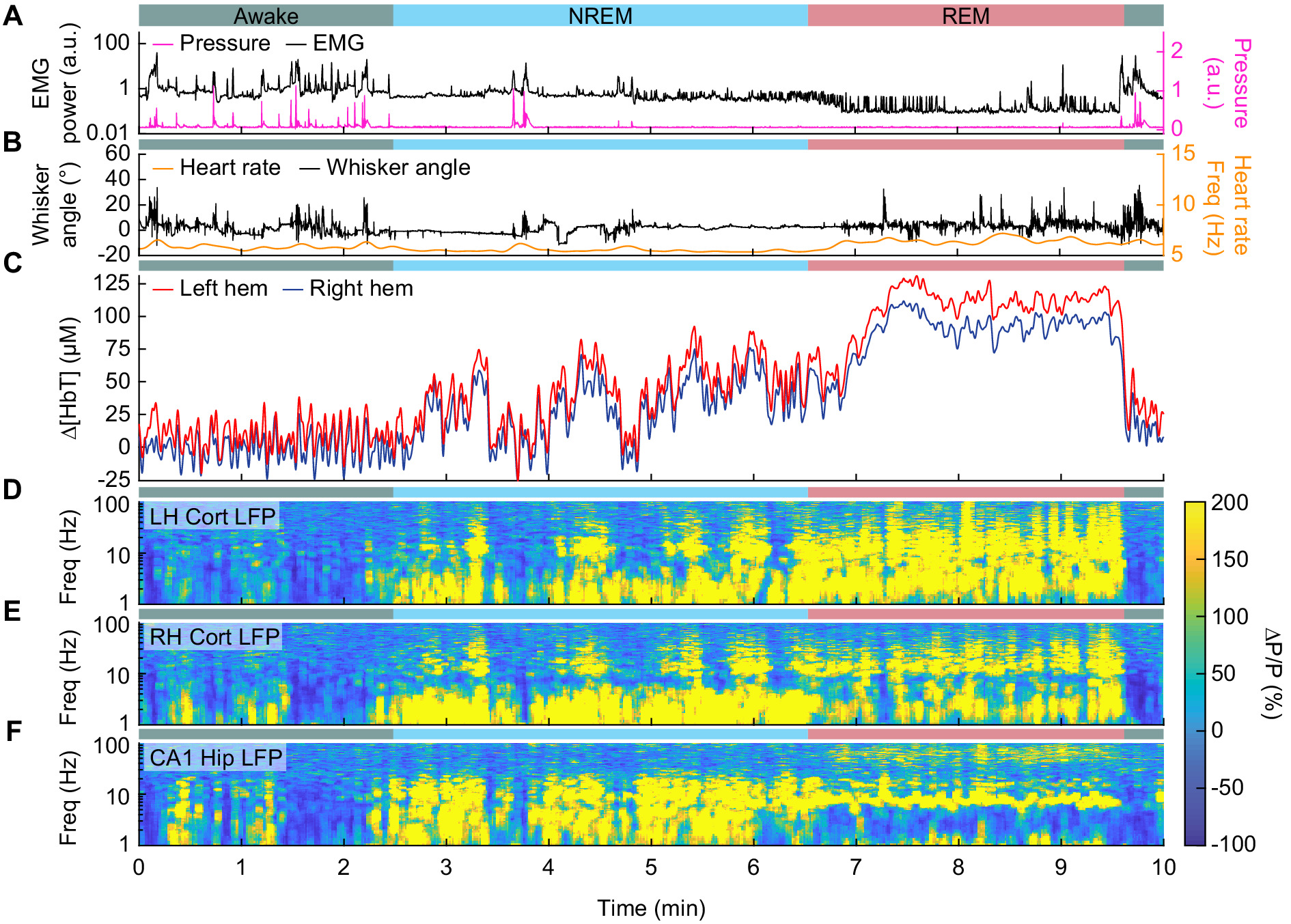 Neurovascular coupling and bilateral connectivity during NREM and REM ...
