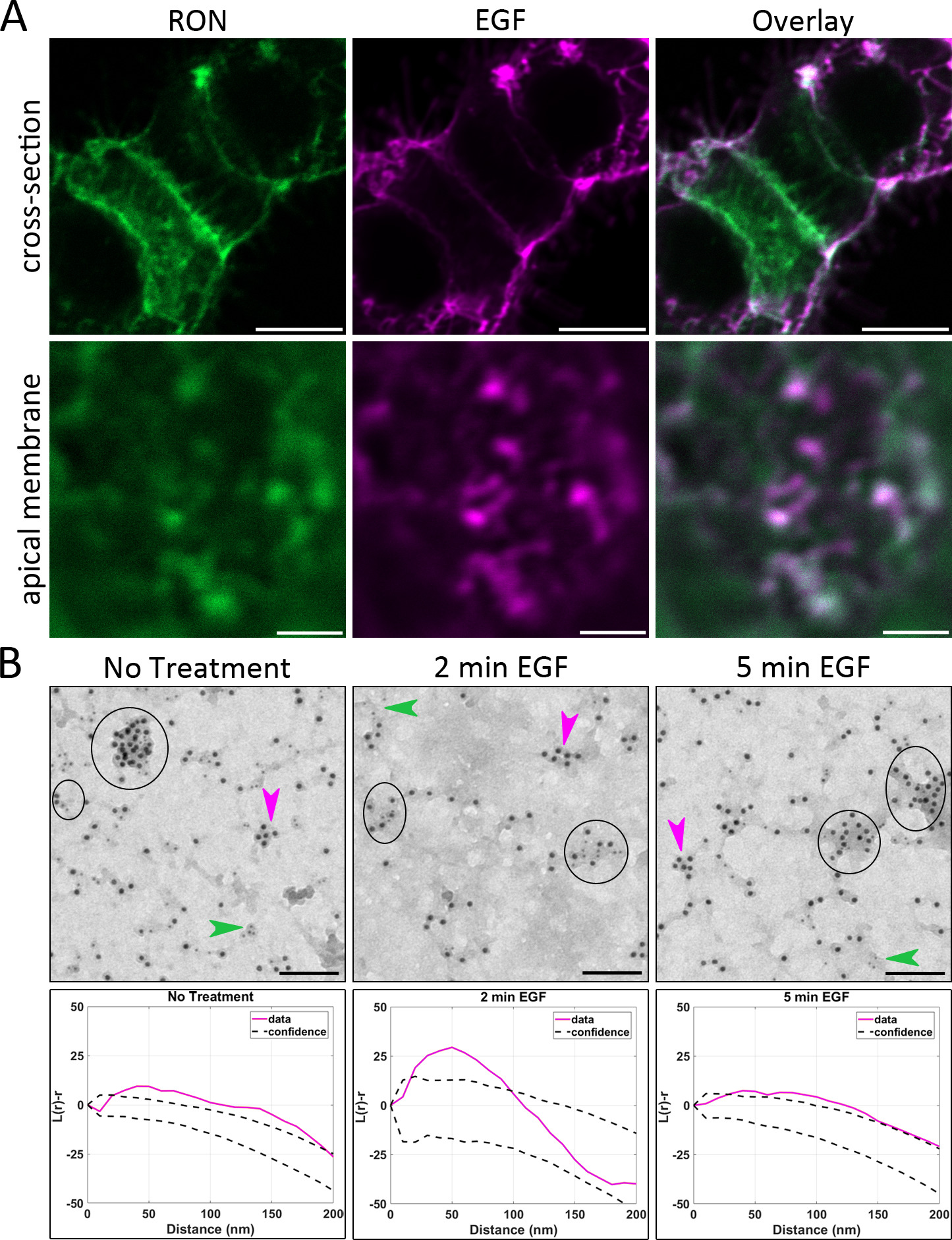 EGFR transactivates RON to drive oncogenic crosstalk | eLife Lens