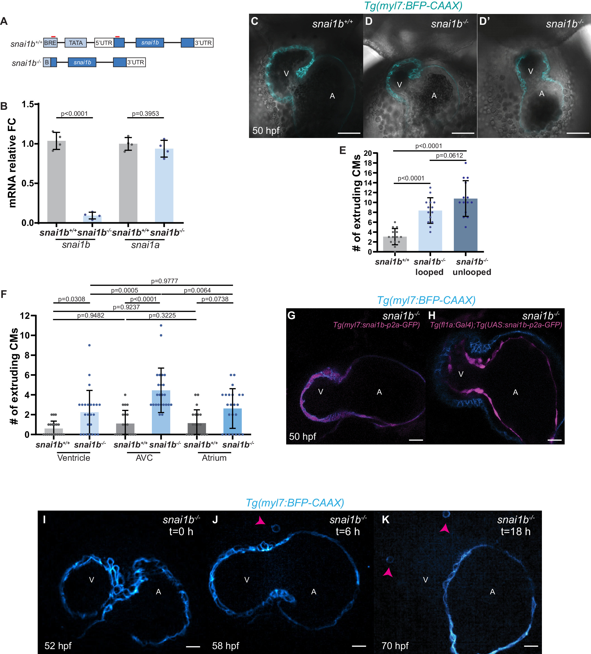 Snail1 The EMT transcription factor Snai1 maintains myocardial wall integrity ...