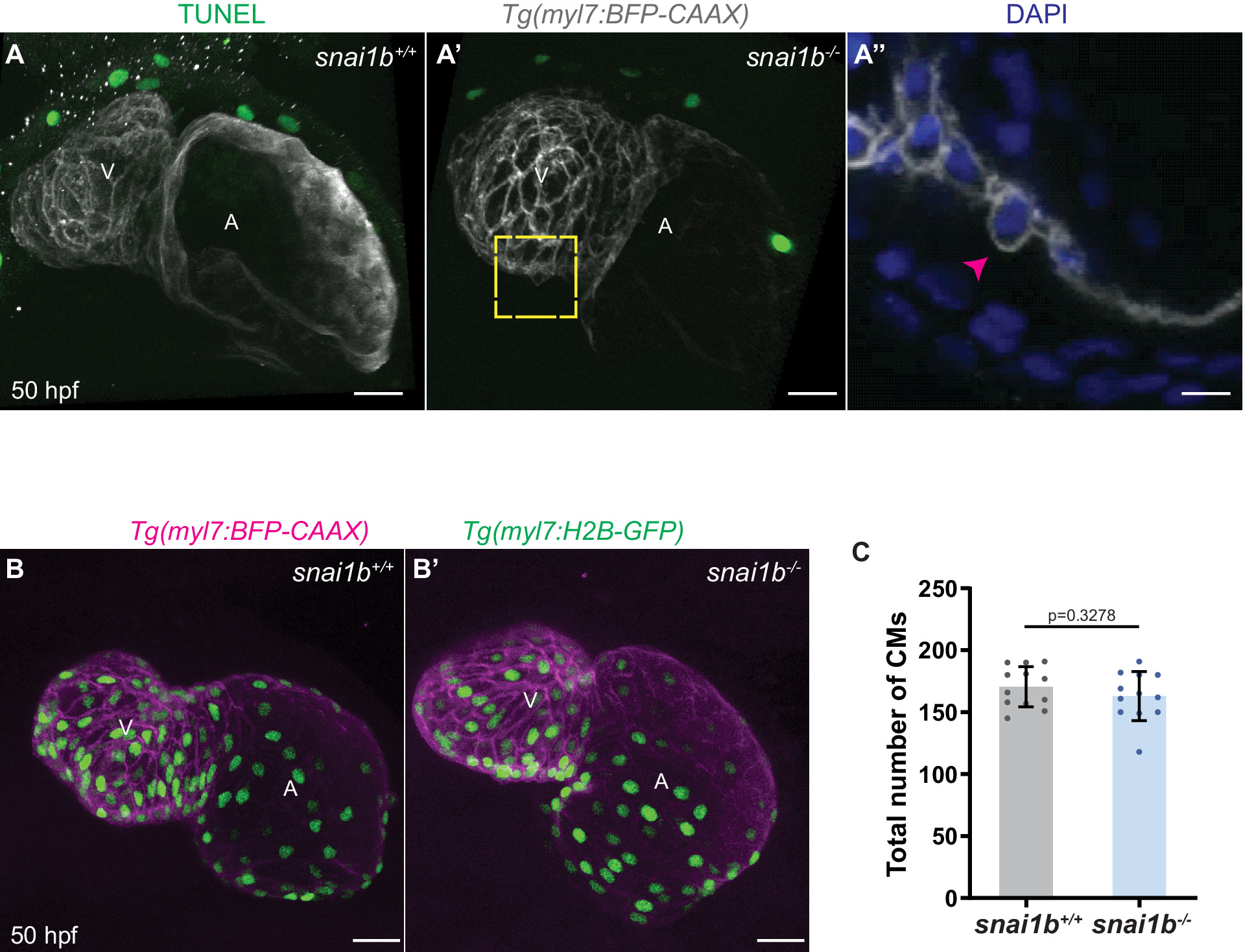 Snail1 The EMT transcription factor Snai1 maintains myocardial wall integrity ...
