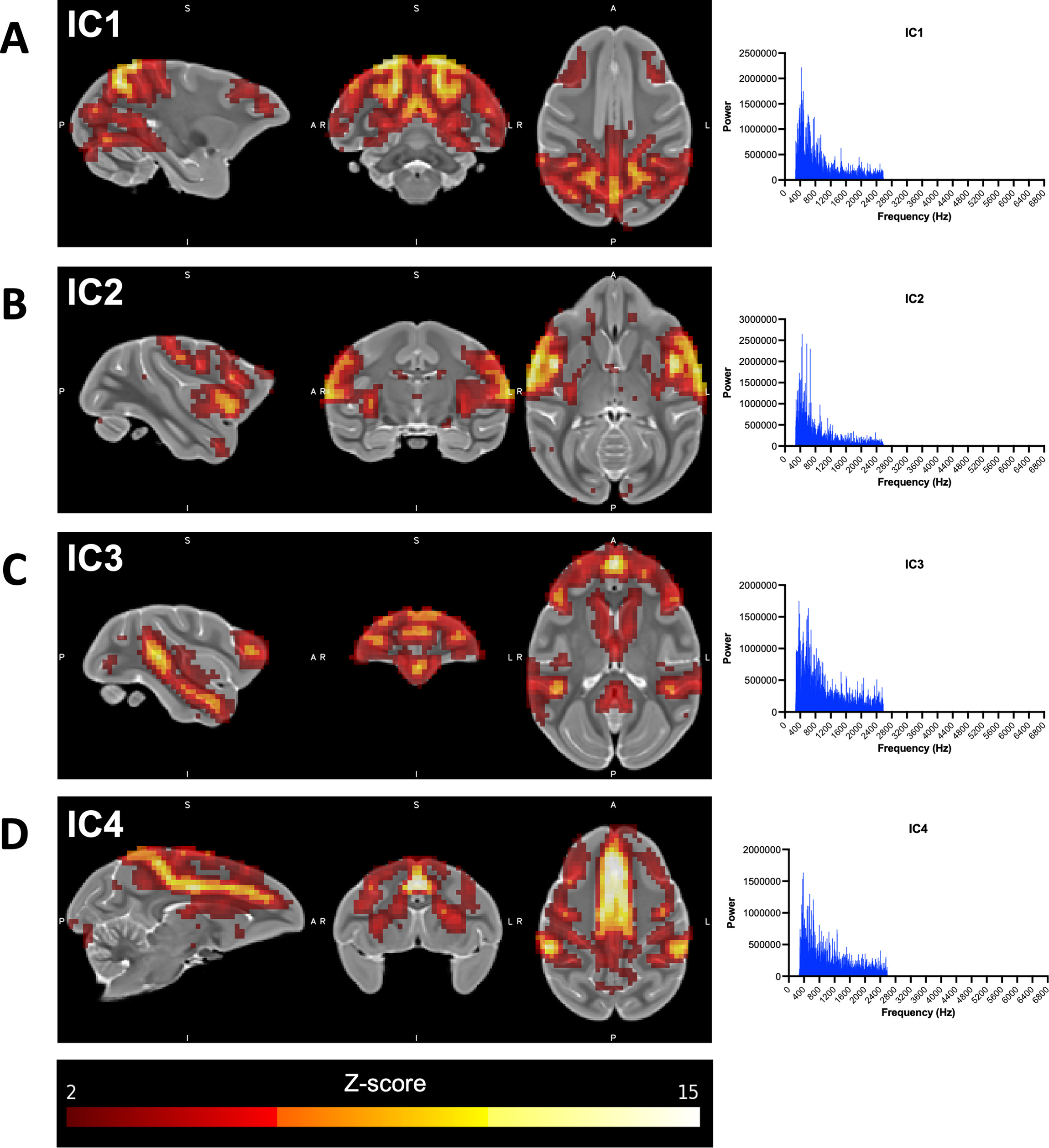 A novel rhesus macaque model of Huntington’s disease recapitulates key ...