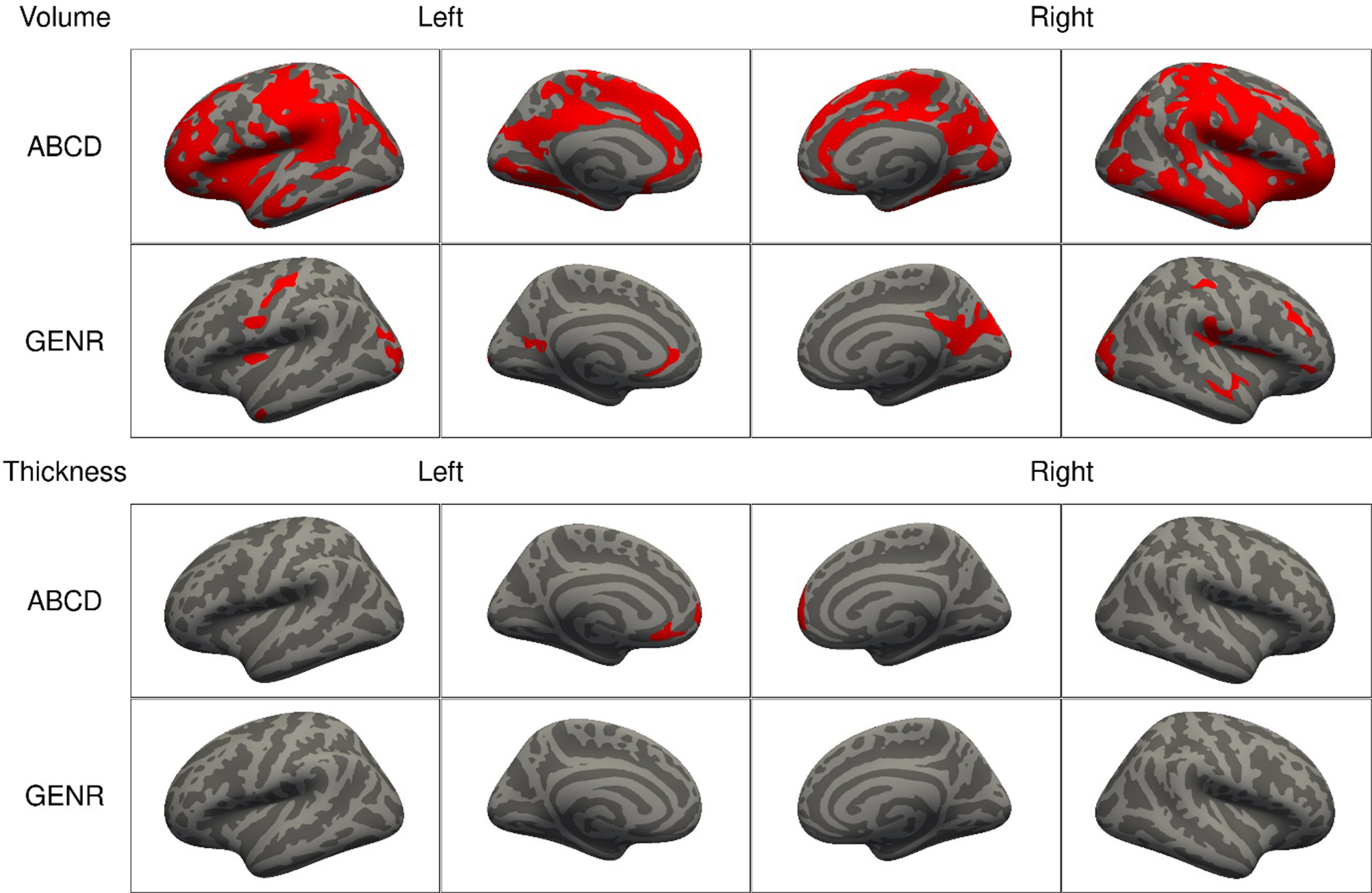 Attention-deficit hyperactivity disorder symptoms and brain morphology ...