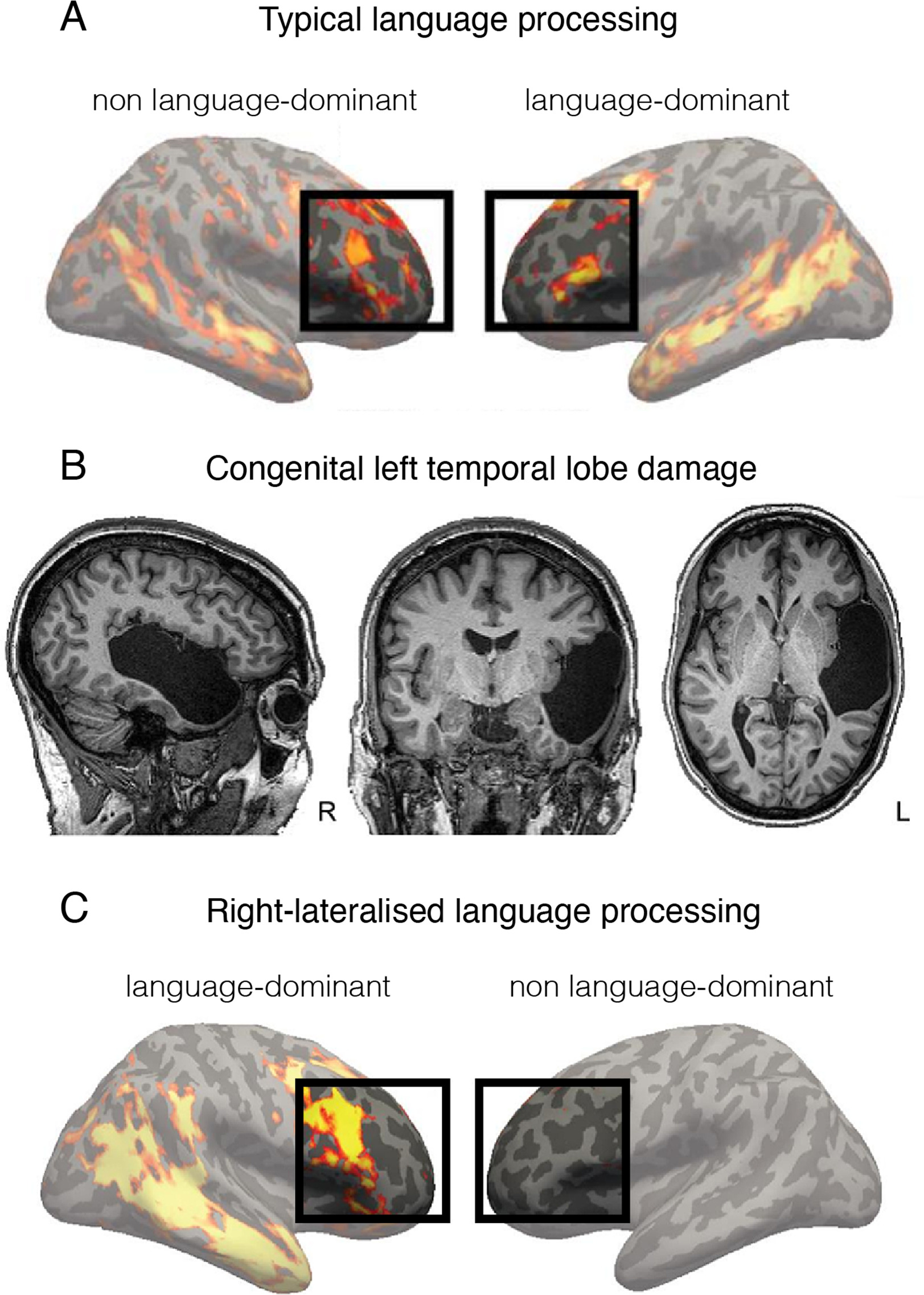 Against cortical reorganisation | eLife Lens