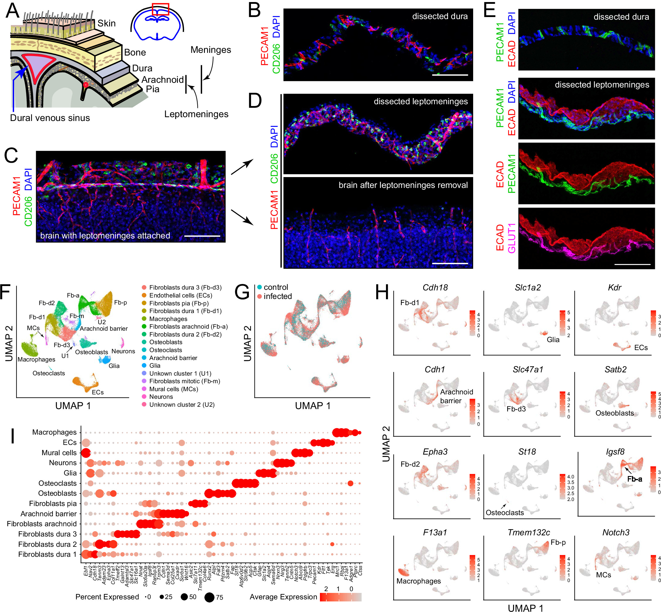 Bacterial meningitis in the early postnatal mouse studied at single ...